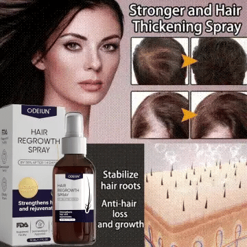 🌿 Odeiun™ Natural Hair Regrowth Spray – 70% OFF Ends Tonight! 🔥