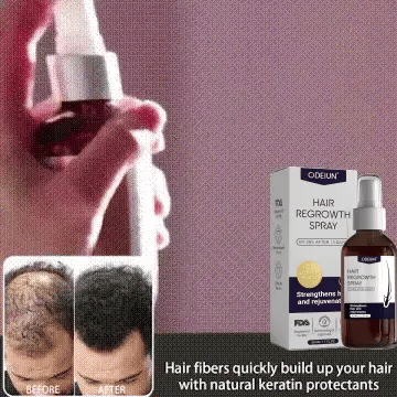 🌿 Odeiun™ Natural Hair Regrowth Spray – 70% OFF Ends Tonight! 🔥